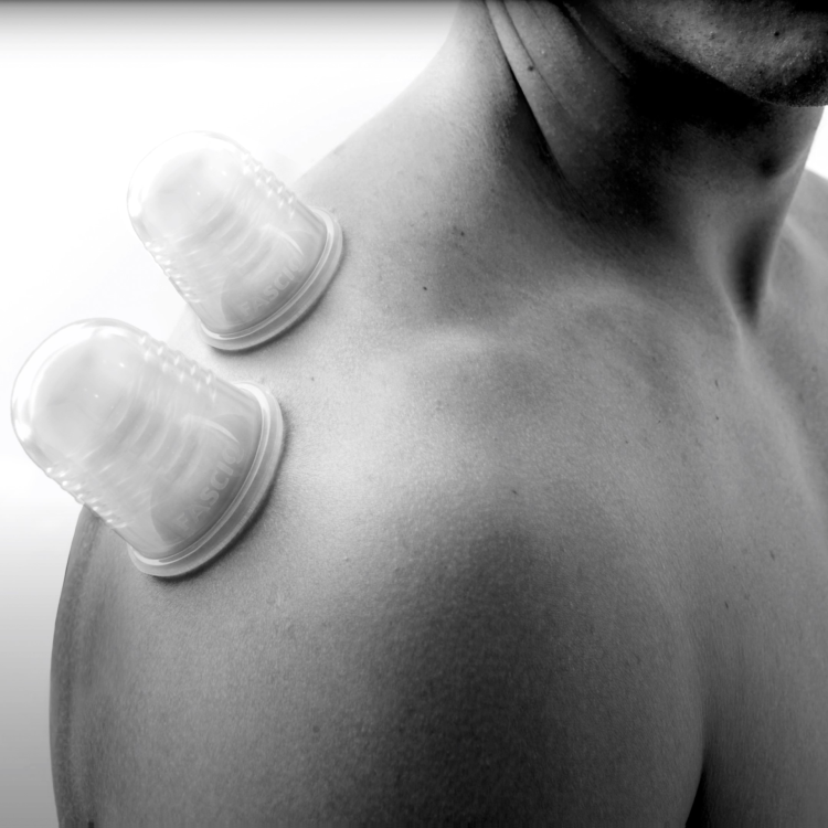 Cupping техника